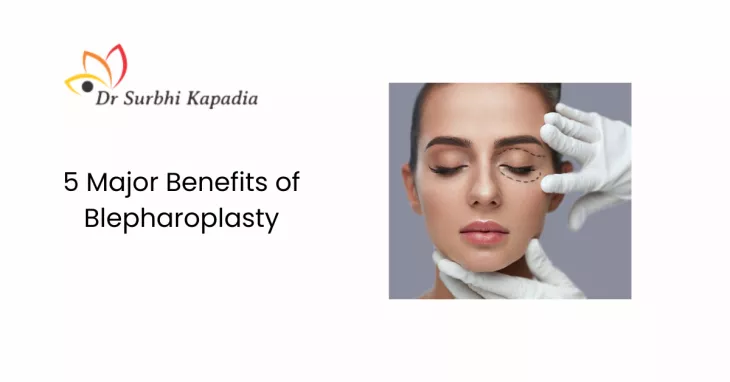 blepharoplasty