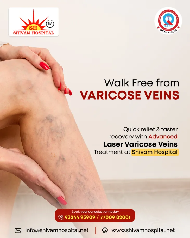  Varicose Veins