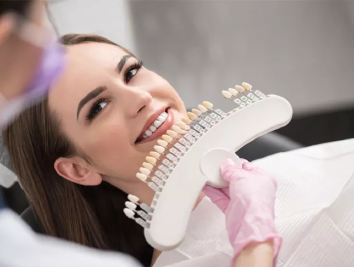 dental veneers