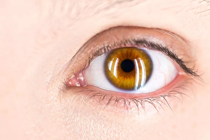 dr swati sinkar paediatric eye specialist ophthalmologist