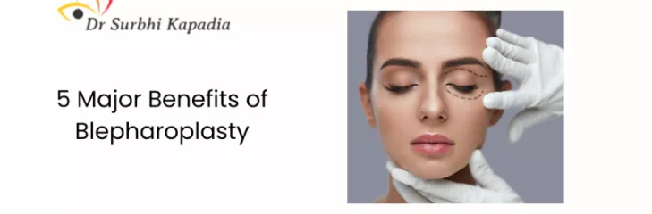 blepharoplasty