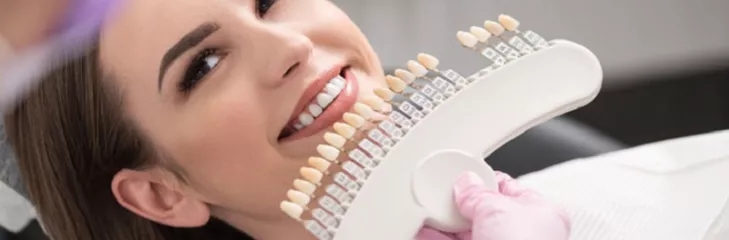 dental veneers