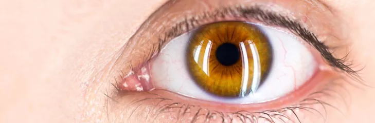 dr swati sinkar paediatric eye specialist ophthalmologist