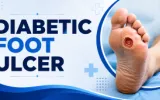 diabetic foot ulcer