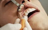 Root Canal Treatment in Gorakhpur