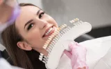 dental veneers