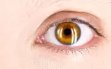 dr swati sinkar paediatric eye specialist ophthalmologist