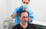 Hair transplantation image